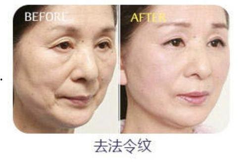 明星网红面部分析,颜值背后的性格密码