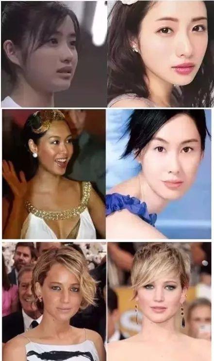 明星网红牙美白,闪耀笑容的秘密武器