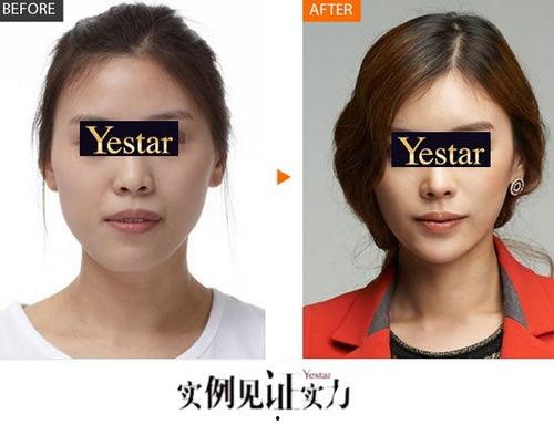 明星网红事故案例分析,揭秘网络影响力下的风险与应对